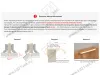 RT110SC.1/000/400 Ручка торцевая 320 мм сатиновый хром <20> превью 4